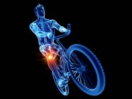 Cyclist silhouette with knee pain, computer illustration. — Stock Photo