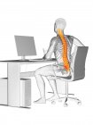 Silhueta de funcionário de escritório sentado na mesa com dor nas costas, ilustração conceitual . — Fotografia de Stock