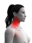 Cuerpo de mujer abstracto con dolor de cuello, ilustración conceptual por ordenador . - foto de stock