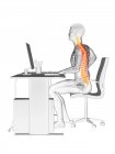 Trabajador de oficina masculino con dolor de espalda, ilustración conceptual . - foto de stock