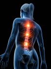 Женский силуэт с сияющей болью в спине, концептуальная цифровая иллюстрация . — стоковое фото