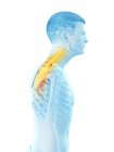 Silhueta masculina com dor no pescoço, ilustração conceitual . — Fotografia de Stock