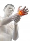 Male body with glowing wrist pain, conceptual illustration. — Stock Photo