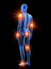 Human body with points of joint pain, conceptual illustration. — Stock Photo