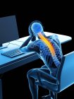Stressed office worker with back pain, conceptual illustration. — Stock Photo