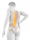 Male silhouette with back pain in low angle view, conceptual illustration. — Stock Photo