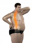 Fettleibige männliche Körper mit Rückenschmerzen, digitale Illustration. — Stockfoto