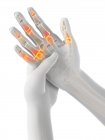 Mains humaines abstraites avec douleur des doigts, illustration conceptuelle . — Photo de stock