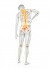 Rear view of male body with inflammation and back pain, conceptual illustration. — Stock Photo