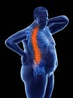 Obese male body with back pain, conceptual illustration. — Stock Photo