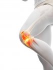 Cuerpo humano con dolor de rodilla, ilustración digital conceptual . - foto de stock