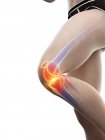 Corpo humano com dor no joelho, ilustração digital conceitual . — Fotografia de Stock