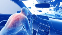 Illustration par rayons X du risque de blessure à la colonne vertébrale lors d'un accident de voiture frontal, illustration numérique . — Photo de stock