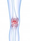 Silhouette umana astratta con dolore al ginocchio, illustrazione concettuale . — Foto stock