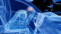 Illustration par rayons X du risque de lésions cérébrales lors d'un accident de voiture frontal, illustration numérique . — Photo de stock