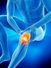 Абстрактное мужское тело с видимой болью в колене, цифровая иллюстрация . — стоковое фото