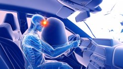 Illustration par rayons X du risque de blessure à la tête lors d'un accident de voiture frontal, illustration numérique . — Photo de stock