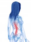 Female silhouette with back pain in rear view, conceptual illustration. — Stock Photo