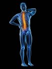 Männlicher Körper mit Rückenschmerzen auf schwarzem Hintergrund, konzeptionelle Illustration. — Stockfoto