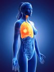 Tumore polmonare nel corpo femminile su sfondo blu, illustrazione digitale . — Foto stock