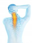 Male body in rear view with visible neck pain, conceptual illustration. — Stock Photo