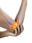Close-up of human body with elbow pain, digital illustration. — Stock Photo