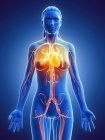 Herzkrankheit im weiblichen Körper, konzeptionelle digitale Illustration. — Stockfoto