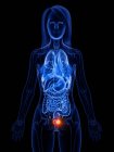 Рак мочевого пузыря в силуэте человеческого тела, концептуальная цифровая иллюстрация . — стоковое фото