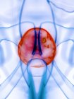 Болезненный мочевой пузырь в абстрактном человеческом теле, концептуальная цифровая иллюстрация . — стоковое фото