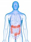 Чоловіче тіло з хворобою товстої кишки, комп'ютерна ілюстрація . — стокове фото
