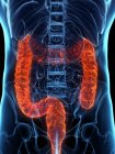 Male body with diseased colon, computer illustration. — Stock Photo