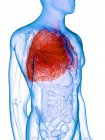 Хворі легені в прозорому чоловічому тілі на білому тлі, комп'ютерна ілюстрація . — стокове фото