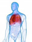 Kranke Lungen im transparenten Männerkörper auf weißem Hintergrund, Computerillustration. — Stockfoto