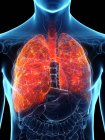 Хворі легені в прозорому чоловічому тілі на чорному тлі, комп'ютерна ілюстрація . — стокове фото