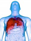 Pulmones enfermos en cuerpo masculino transparente sobre fondo blanco, ilustración por computadora . - foto de stock