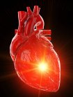 Человеческое сердце с болезнями, компьютерная иллюстрация
. — стоковое фото