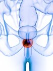 Inflamed prostate in abstract male body, digital illustration. — Stock Photo