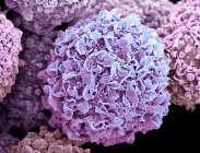 Micrógrafo electrónico de barrido coloreado de células cancerosas de mama
. - foto de stock