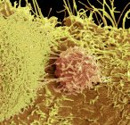 Micrografo elettronico a scansione colorata della superficie delle cellule tumorali della prostata
. — Foto stock
