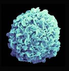 Coloured scanning electron micrograph of breast cancer cell. — Stock Photo