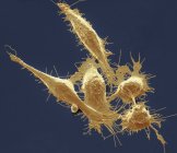 Кольоровий скануючий електронний мікрограф ракових клітин з товстої кишки.. — стокове фото