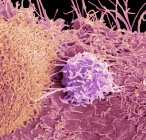 Кольоровий скануючий електронний мікрограф поверхні ракових клітин простати.. — стокове фото