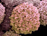 Farbige Rasterelektronenmikroskopie der Brustkrebszelle. — Stockfoto