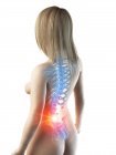 Corpo femminile astratto con mal di schiena, illustrazione digitale concettuale . — Foto stock