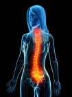 Abstrakter weiblicher Körper mit Rückenschmerzen, konzeptionelle digitale Illustration. — Stockfoto