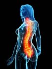 Abstract female body with back pain, conceptual digital illustration. — Stock Photo