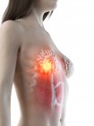 Corpo astratto femminile con cancro al seno incandescente, illustrazione concettuale del computer . — Foto stock
