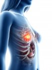 Женское абстрактное тело с сияющим раком молочной железы, концептуальная компьютерная иллюстрация
. — стоковое фото