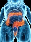 Cuerpo femenino con colon enfermo, ilustración digital . - foto de stock