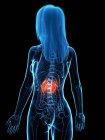Diseased glowing kidneys in female body, conceptual digital illustration. — Stock Photo